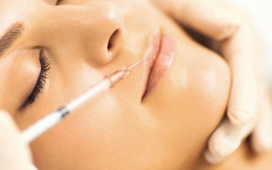 Botox for Gummy Smile and Lip Flip in Chevy Chase, Maryland